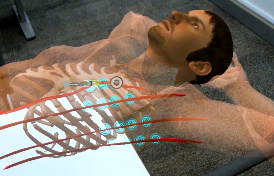 HoloPrognose